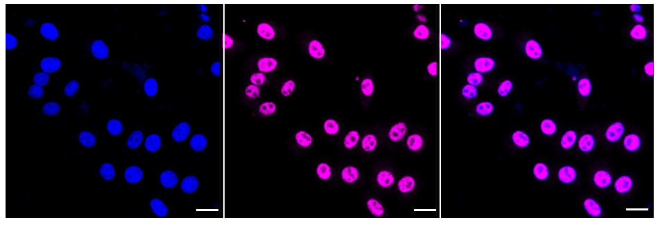 TOR/mTOR [p Ser2481] Antibody (24GB325)