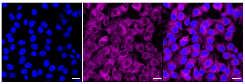 TOR/mTOR [p Ser2448] Antibody (24GB330)