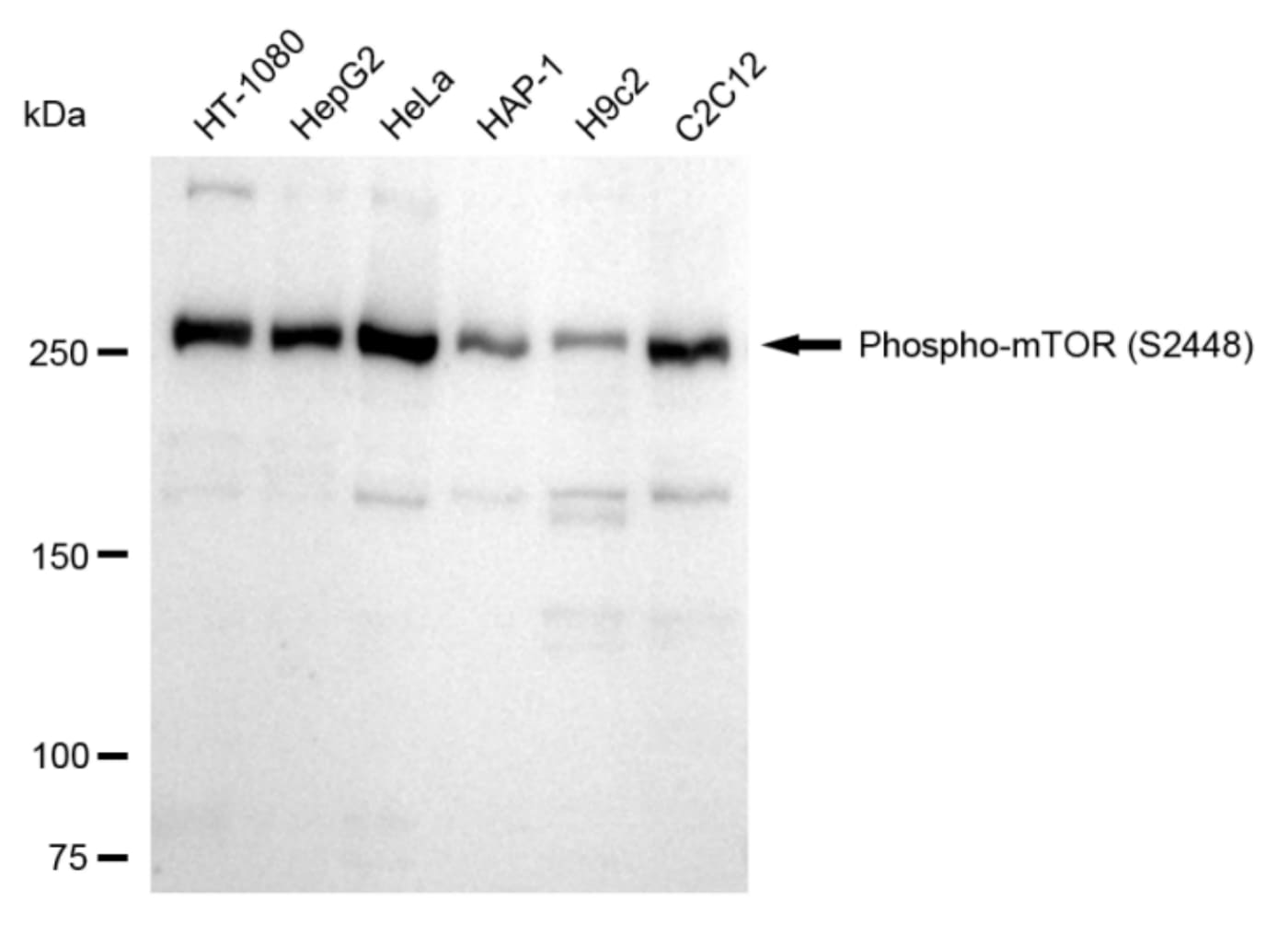 TOR/mTOR [p Ser2448] Antibody (24GB330)