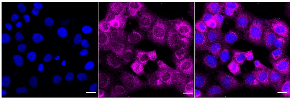 NQO-1 Antibody (24GB355)