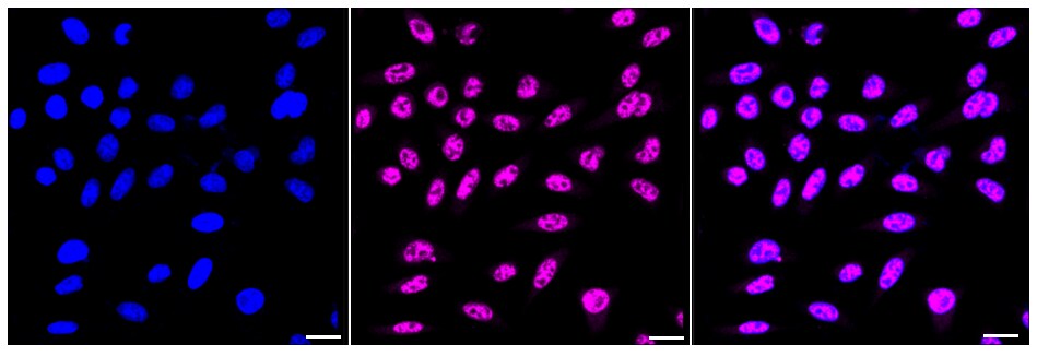PABPN1 Antibody (24GB365)