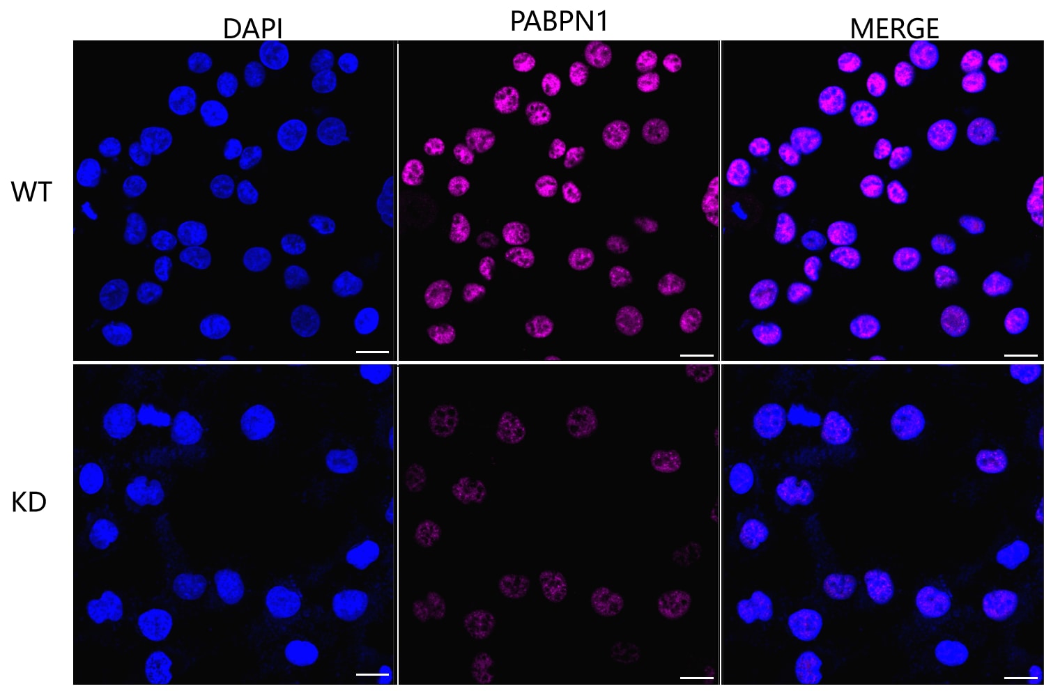 PABPN1 Antibody (24GB365)