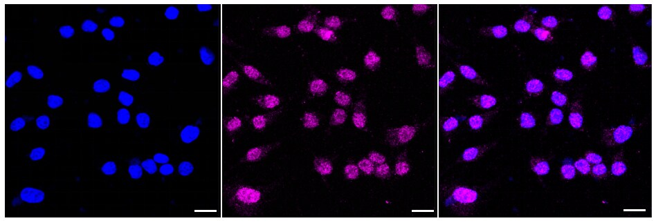 MVP Antibody (24GB465)