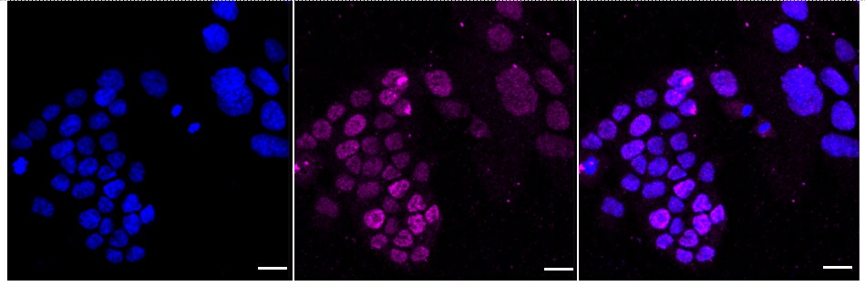 Matrin 3 Antibody (24GB535)
