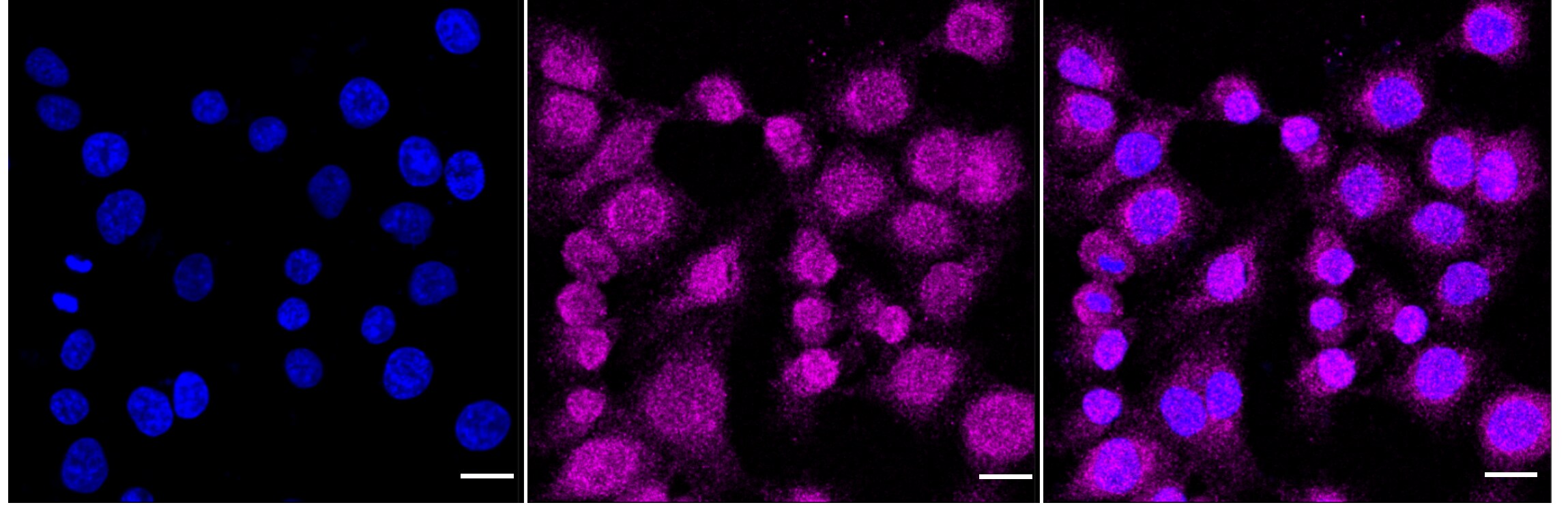 LRG1 Antibody (24GB545)