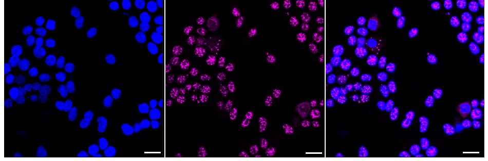 MOV10 Antibody (24GB575)