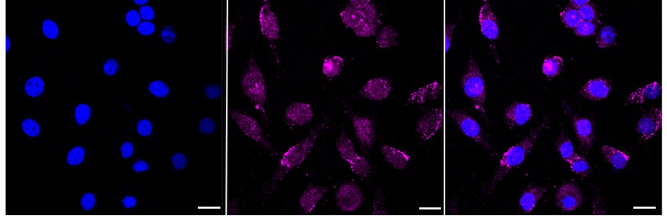 NLK Antibody (24GB585)
