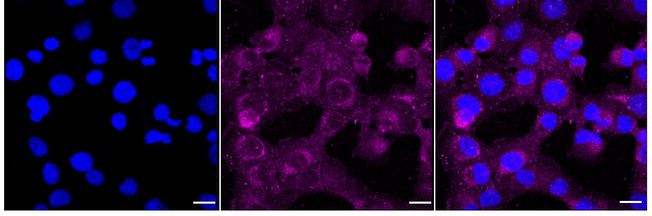 MARK2 Antibody (24GB675)