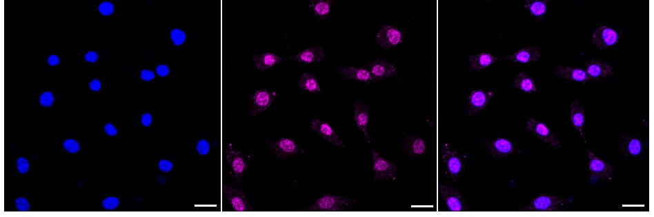 OLFM4 Antibody (24GB680)