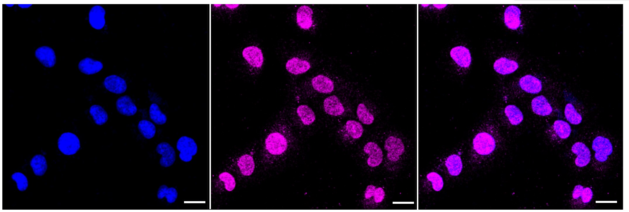 beta-Galactosidase-1/GLB1 Antibody (23GB1580)