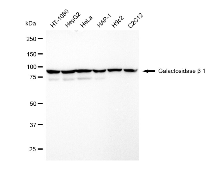 beta-Galactosidase-1/GLB1 Antibody (23GB1580)