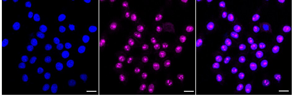 Lyn Antibody (24GB720)