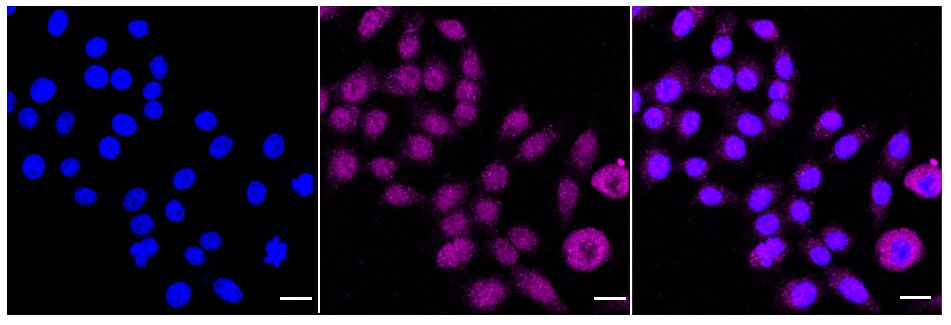 TR4/NR2C2 Antibody (24GB730)