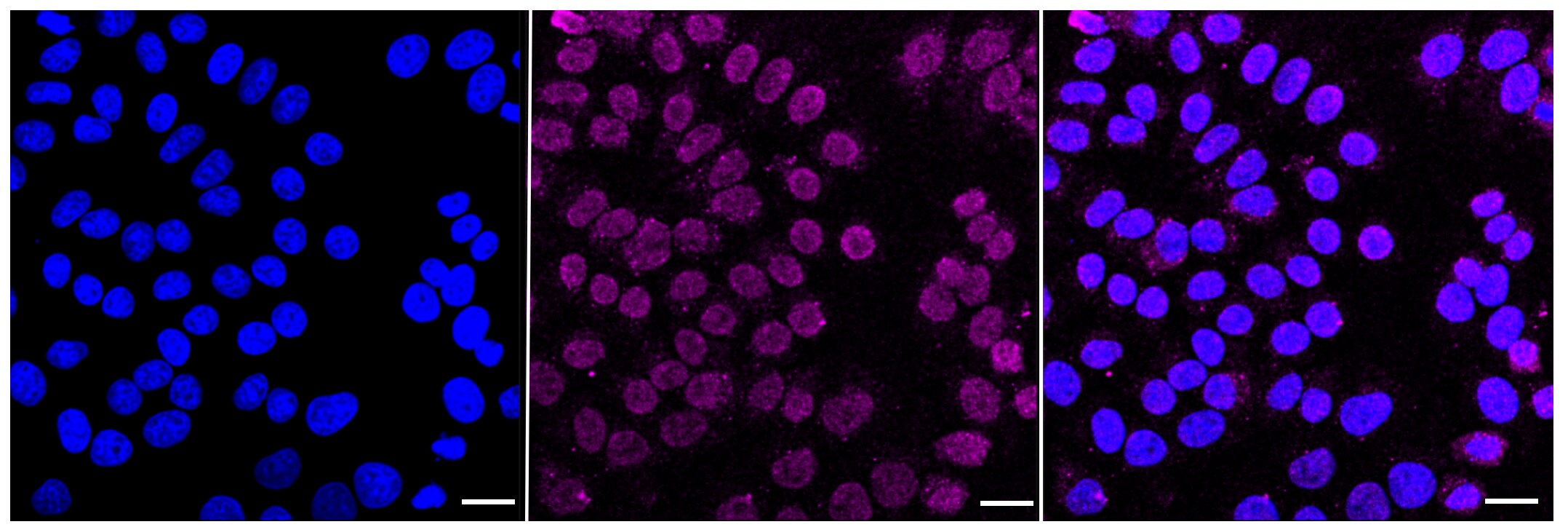 Pyruvate Dehydrogenase E2 Antibody (23GB1010)
