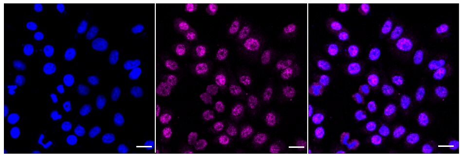 PCBD1 Antibody (24GB785)