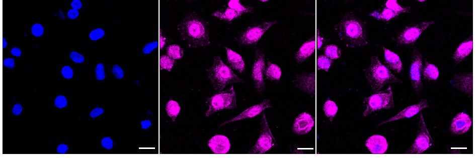 RAVER2 Antibody (24GB810)
