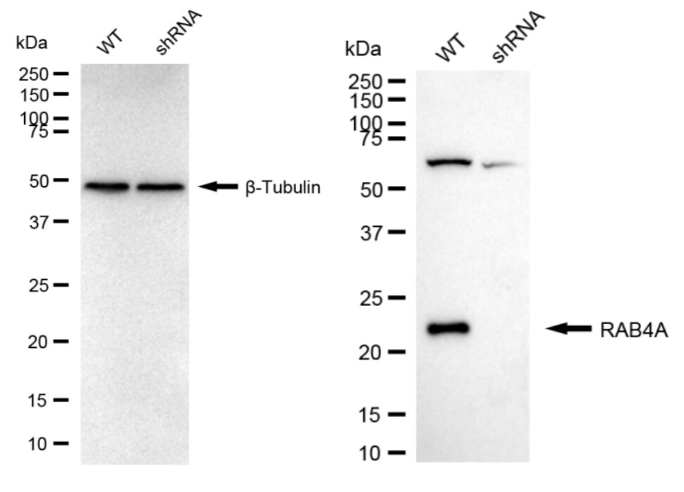 Rab4 Antibody (24GB825)