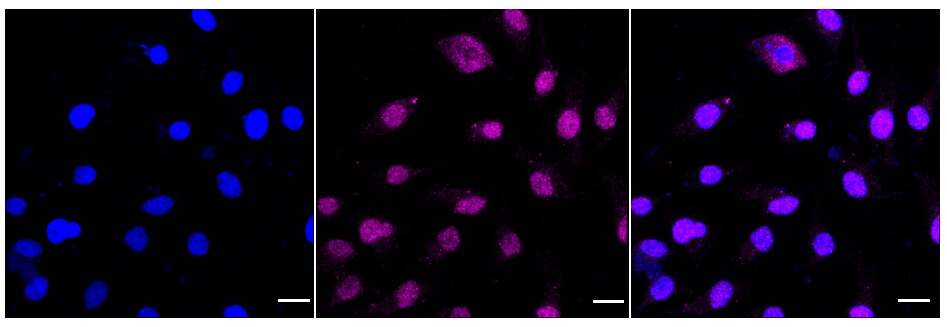 LEDGF Antibody (24GB840)