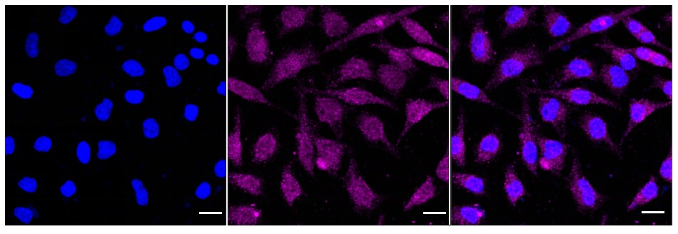 PRMT5 Antibody (24GB845)