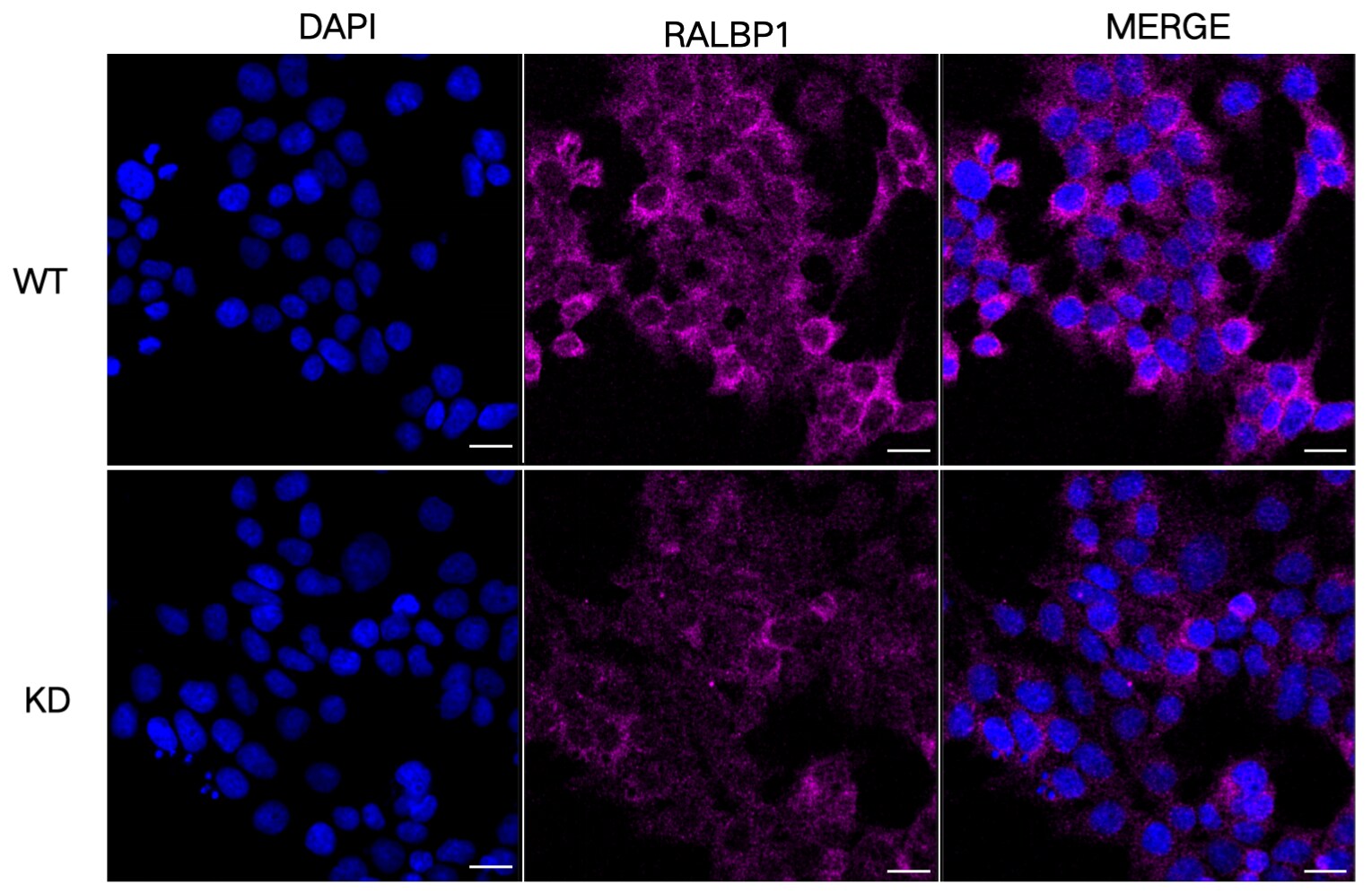 RALBP1 Antibody (24GB875)