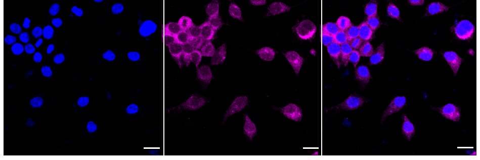 RALBP1 Antibody (24GB875)