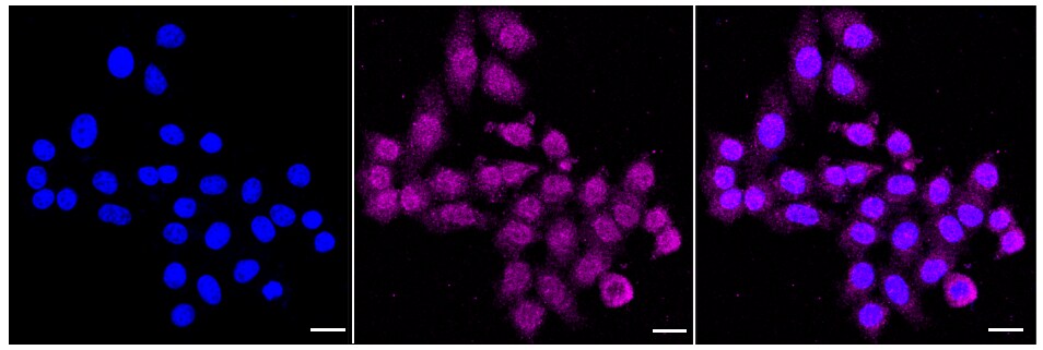 Cyclophilin A Antibody (24GB905)