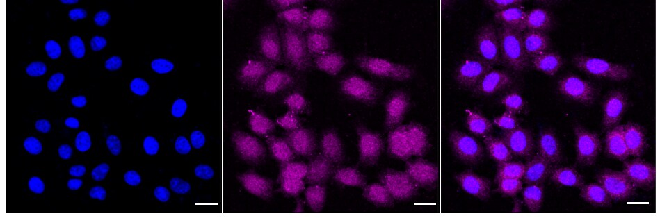 Peroxiredoxin 6 Antibody (24GB910)