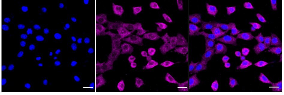 RelB Antibody (24GB925)