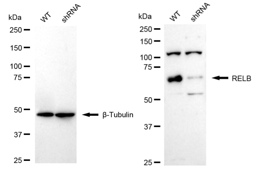 RelB Antibody (24GB925)
