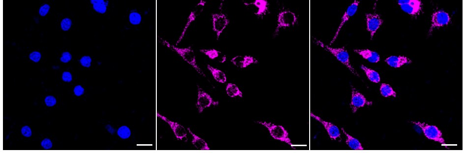 Peroxiredoxin 3 Antibody (24GB935)