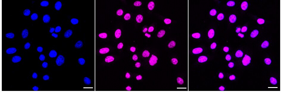 PRPF4 Antibody (24GB975)