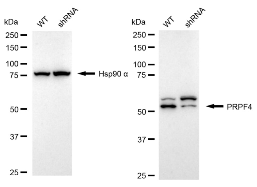 PRPF4 Antibody (24GB975)