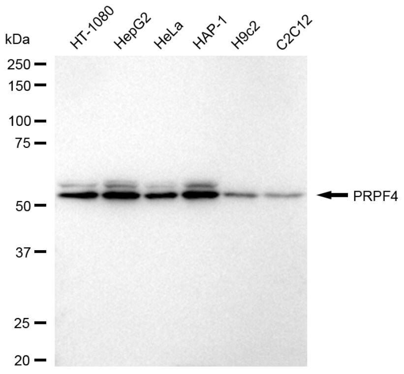 PRPF4 Antibody (24GB975)