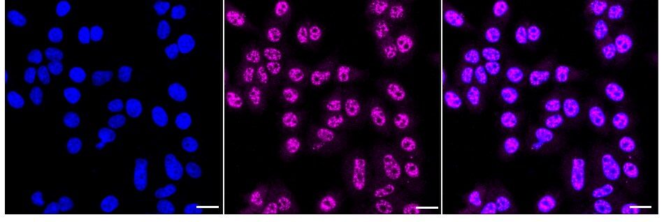 PMF1 Antibody (24GB985)