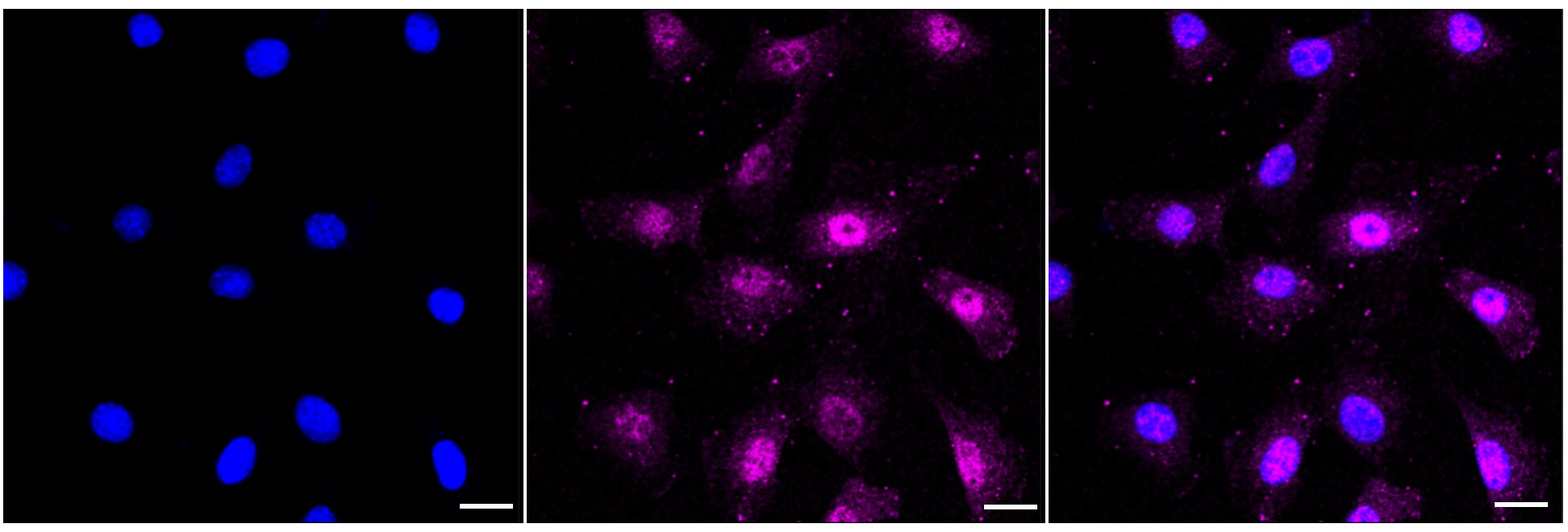 AKT1 [p Ser124] Antibody (23GB1180)