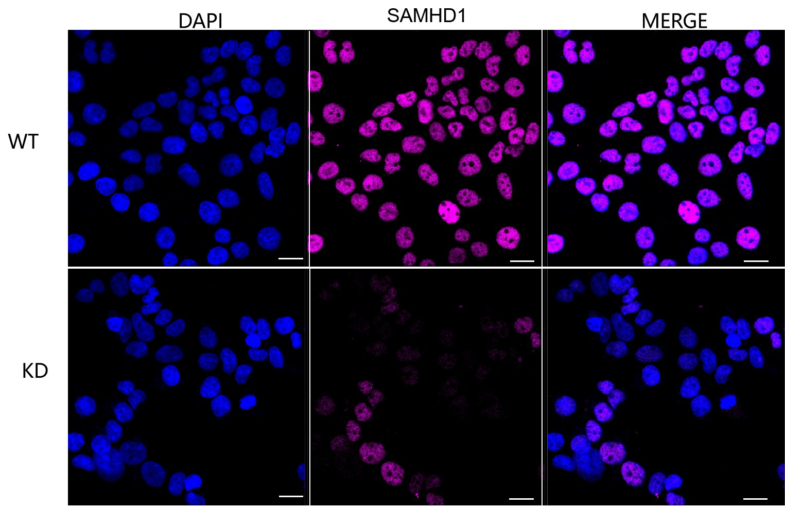 SAMHD1 Antibody (24GB1010)