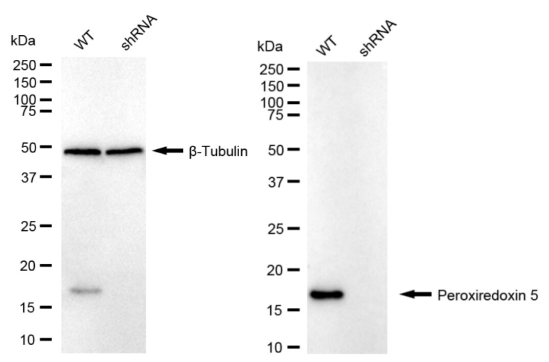 Peroxiredoxin 5 Antibody (24GB1025)