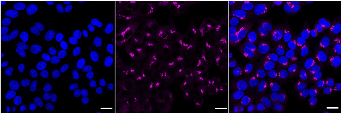 VDP p115 Antibody (24GB1905)