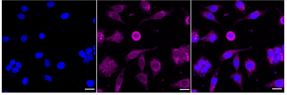 RAR beta/NR1B2 Antibody (24GB1045)