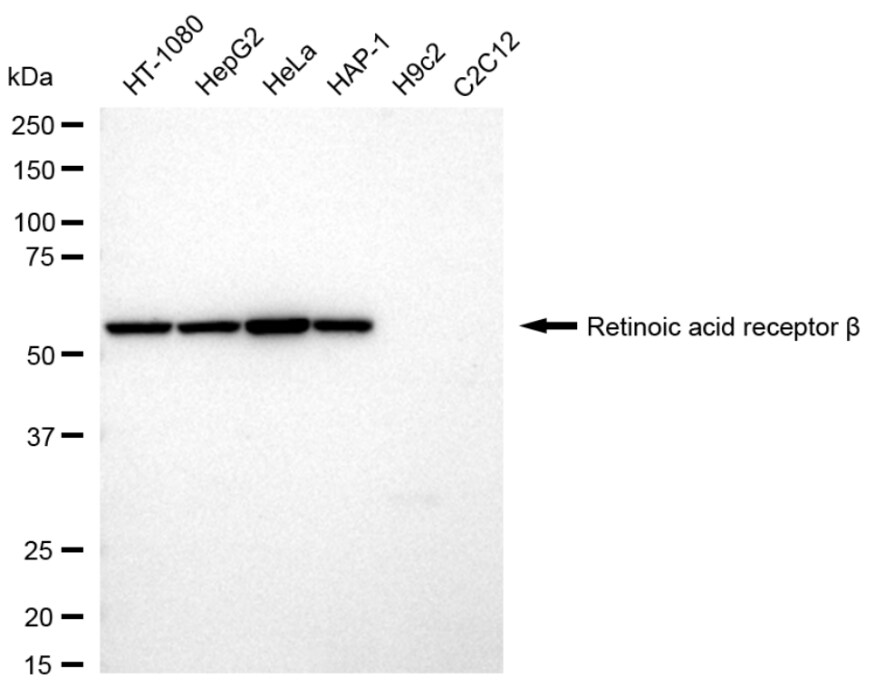 RAR beta/NR1B2 Antibody (24GB1045)