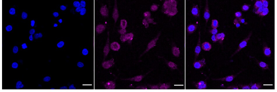 SDHC Antibody (24GB1075)
