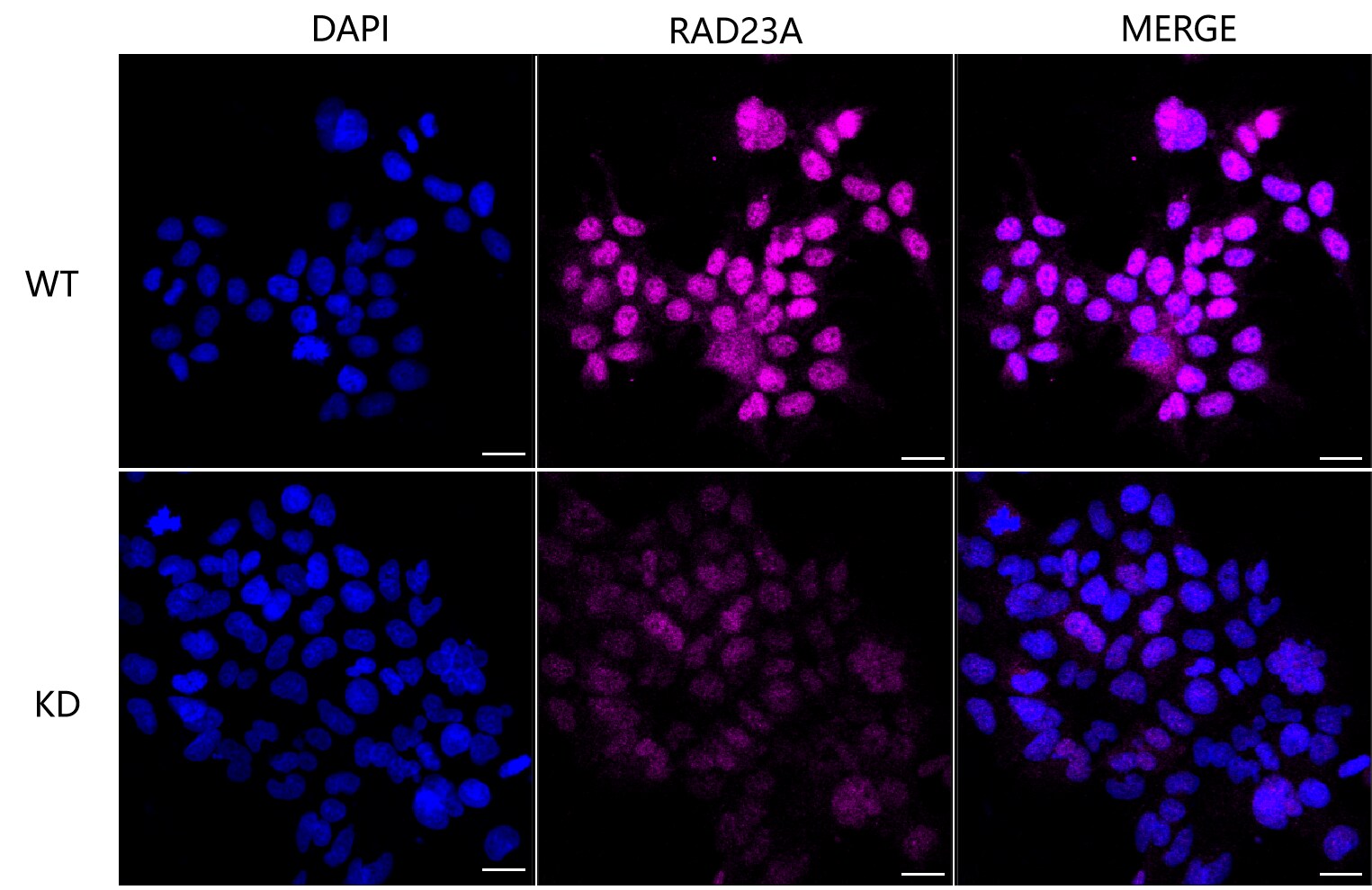 Rad23 Antibody (24GB1080)