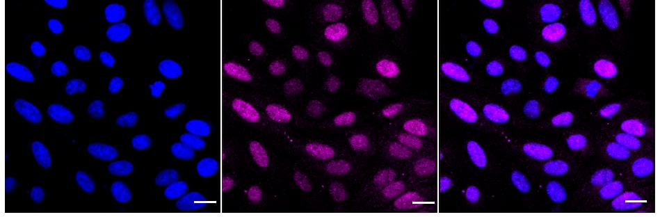 Rad23 Antibody (24GB1080)