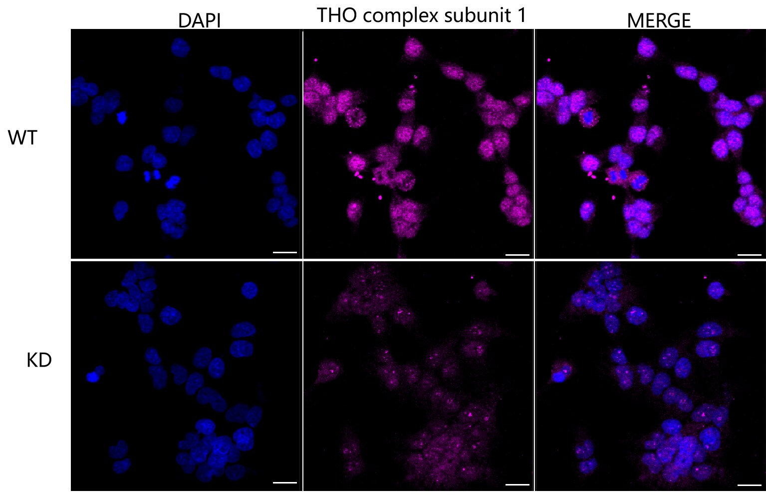 hHpr1-p84-Thoc1 Antibody (24GB2205)