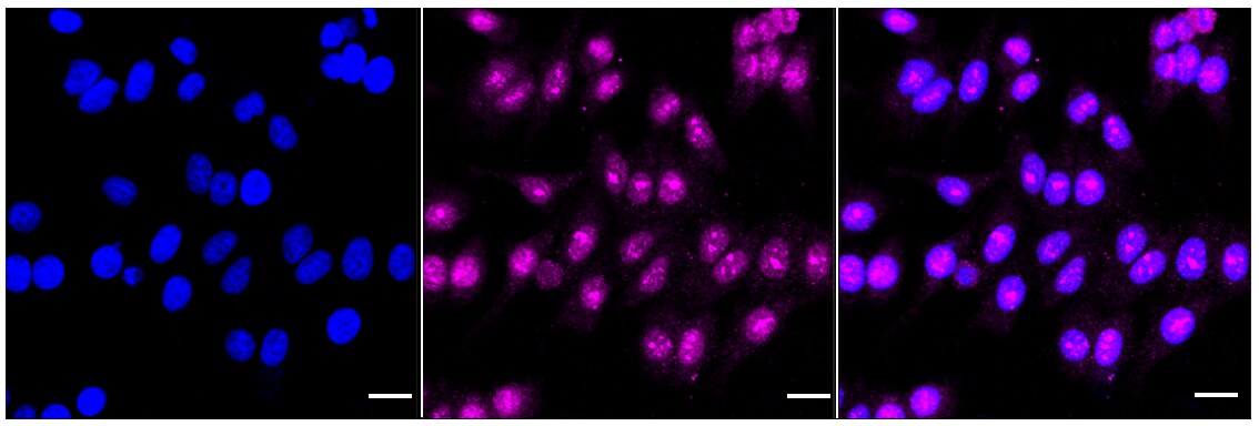 hHpr1-p84-Thoc1 Antibody (24GB2205)