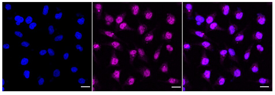 DNA Polymerase gamma Antibody (24GB1085)