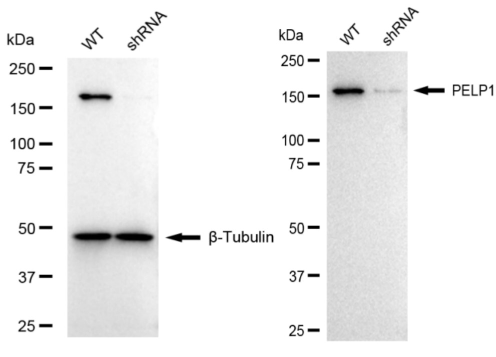 PELP1 Antibody (24GB1145)