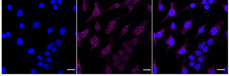 VPS34 Antibody (24GB1150)