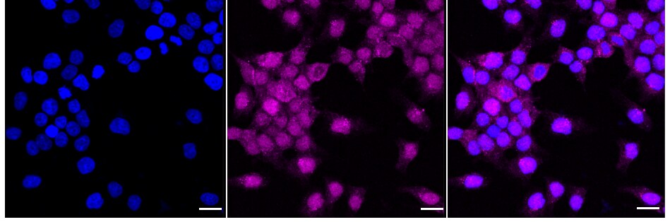 p70 S6 Kinase beta/S6K2 Antibody (24GB1235)