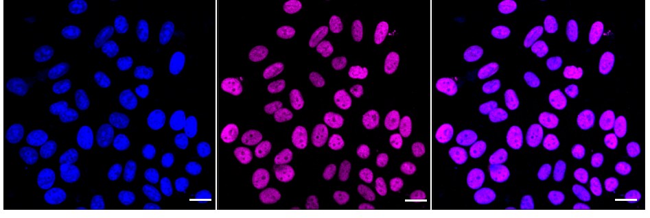 RBBP4/RbAp48 Antibody (24GB1240)
